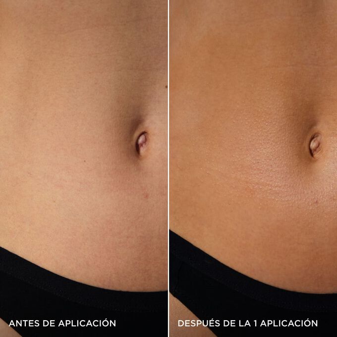 Antes y despu&eacute;s del vientre de una mujer, mostrando un brillo dorado natural tras una aplicaci&oacute;n del autobronceador Express Self-Tan Gel de Clarins.